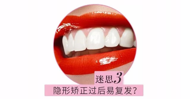 隐形矫正过后易复发？