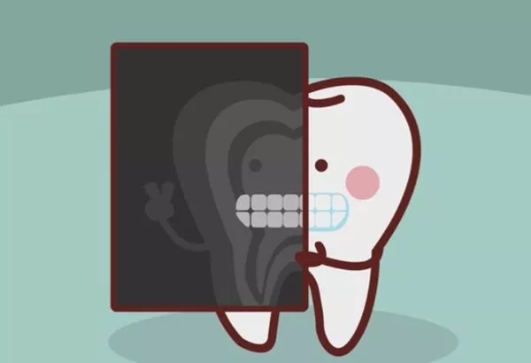 牙齿矫正为什么要拍片？矫正前，医生的检查有哪些？