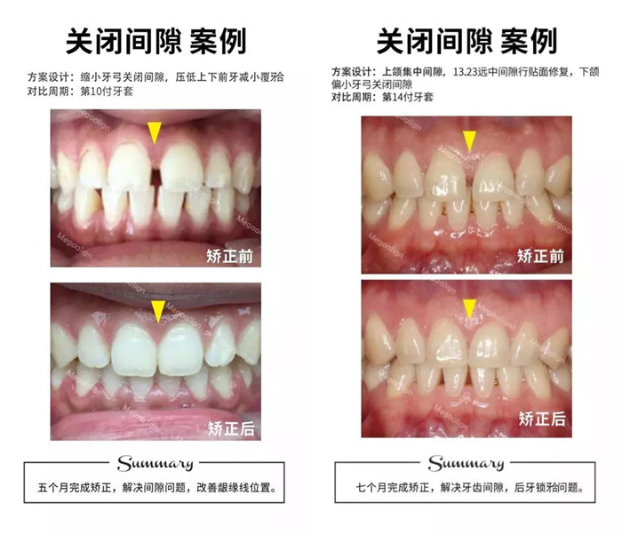 易齐微矫案例赏析