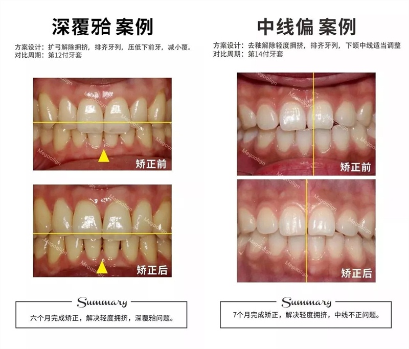 易齐微矫案例