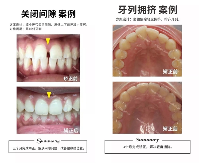 易齐微矫案例