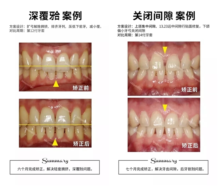 易齐微矫案例