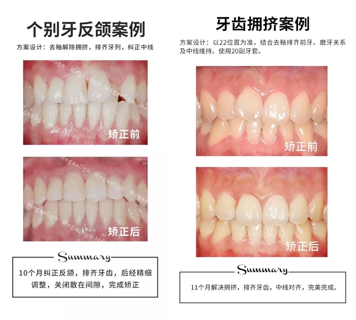 易齐微矫案例