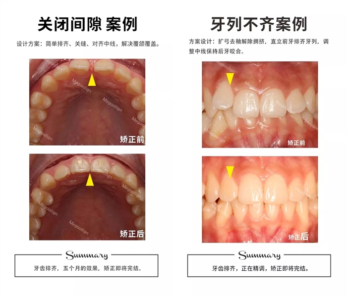 易齐微矫案例