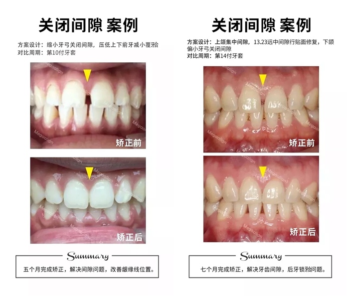 易齐微矫方案案例