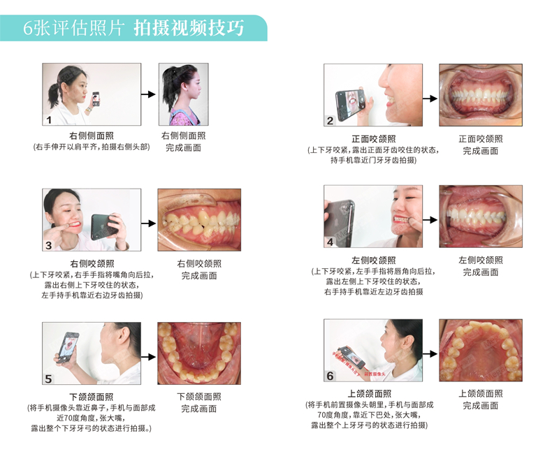 如何视频面诊